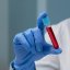 Novas evidências sobre o exame de sangue que pode detetar até 50 tipos de cancro