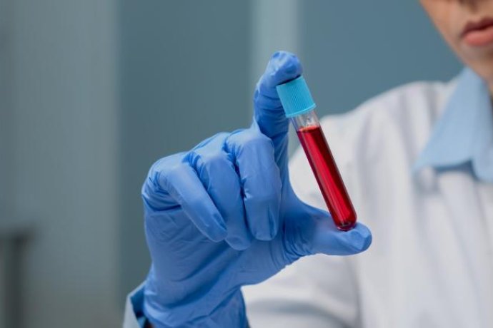 Novas evidências sobre o exame de sangue que pode detetar até 50 tipos de cancro