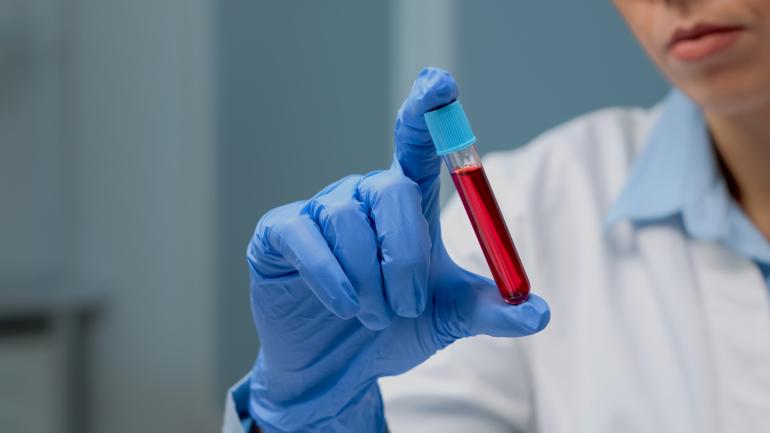 Novas evidências sobre o exame de sangue que pode detetar até 50 tipos de cancro